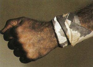 Arm ornament,1981, by Pierre Degen (1947). Newspaper and soot