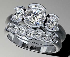 CAD/CAM Wedding Set Finishing and Setting