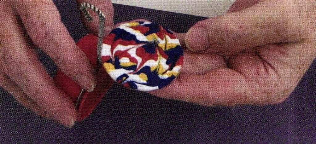 Fig 5. Vibrating edge to smooth enamel surface