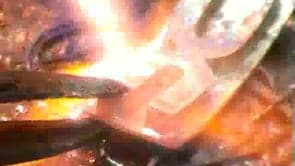 Sun Bracelet – Part 3 (addition)