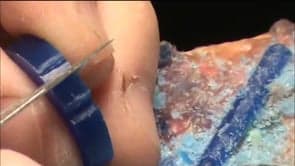 Tanzanite Ring part one