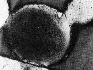 Copper Granulation Technique - Figure 2