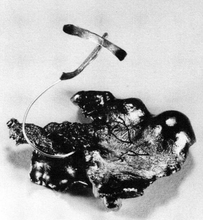 Tim McInery - 57th Annual National High School Art Exhibition